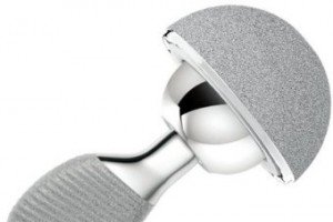 Toxic Faulty Hip Replacement